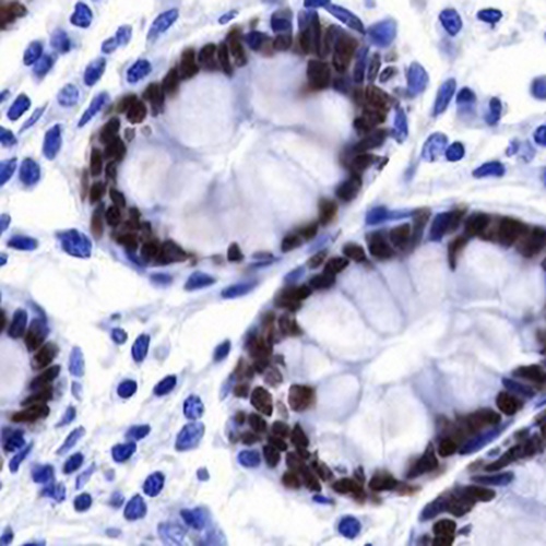 SATB2 Rabbit Monoclonal Antibody(C747)