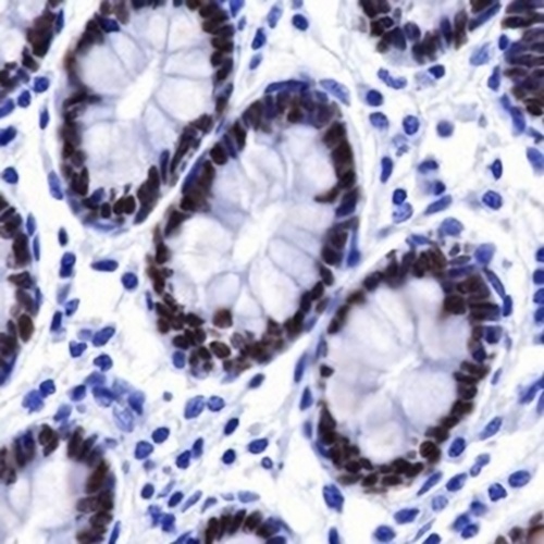 SATB2 Rabbit Monoclonal Antibody(C748)