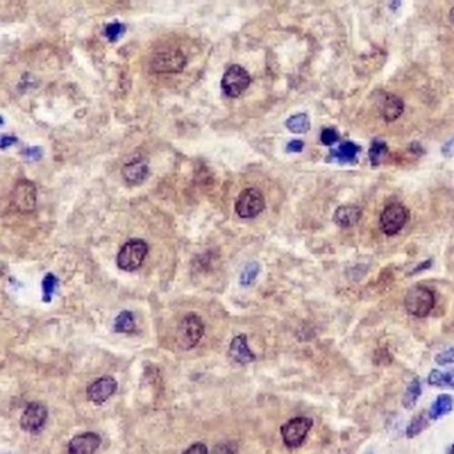 SETBP1 Rabbit Monoclonal Antibody(C749)