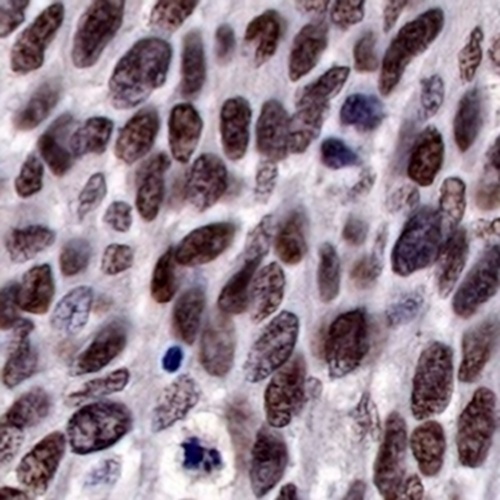 SOX10 Rabbit Monoclonal Antibody(C751)