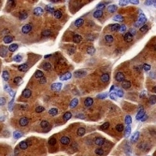 SPINK1 Rabbit Monoclonal Antibody(C752)