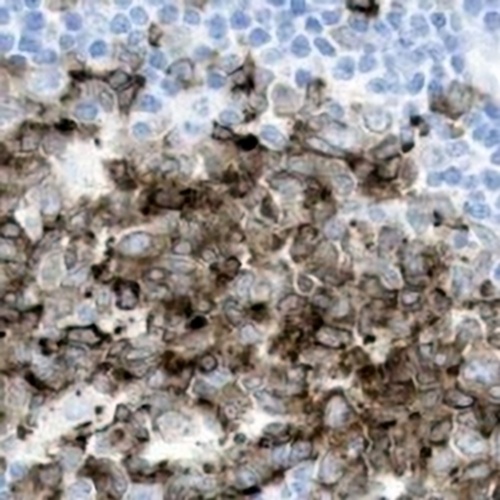 STMN1 Rabbit Monoclonal Antibody(C754)
