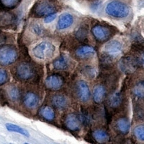 TAU Rabbit Monoclonal Antibody(C756)