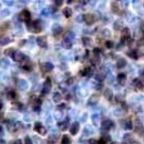 TCL-1A Rabbit Monoclonal Antibody(C757)