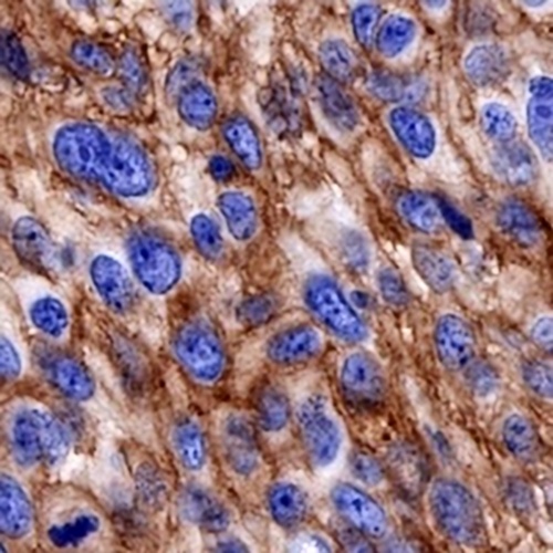 CD141 Rabbit Monoclonal Antibody(C758)