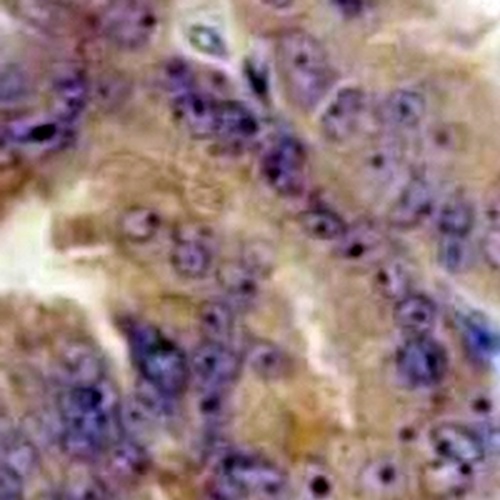 URI1 Rabbit Monoclonal Antibody(C760)