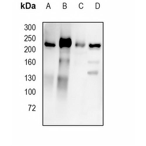 VEGFR2 Rabbit Monoclonal Antibody(C761)