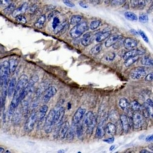 Villin Rabbit Monoclonal Antibody(C762)