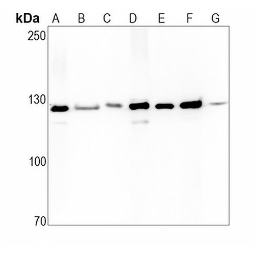 Vinculin Rabbit Monoclonal Antibody(C763)