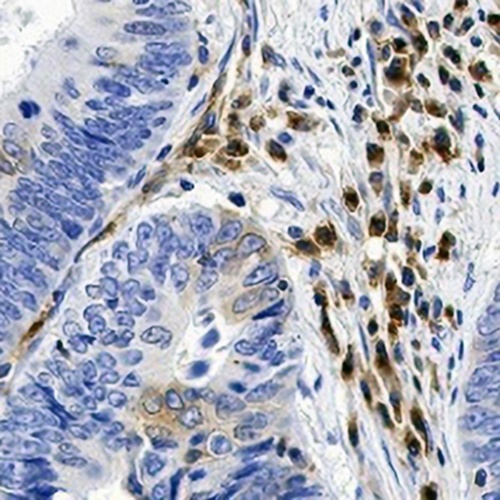 VIPR1 Rabbit Monoclonal Antibody(C764)