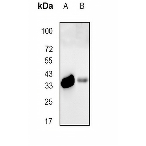 Calponin 1 Rabbit Monoclonal Antibody(C766)