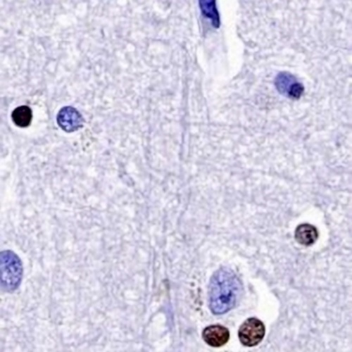 SOX10 Rabbit Monoclonal Antibody(C768)