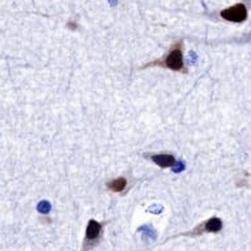 SATB2 Rabbit Monoclonal Antibody(C769)