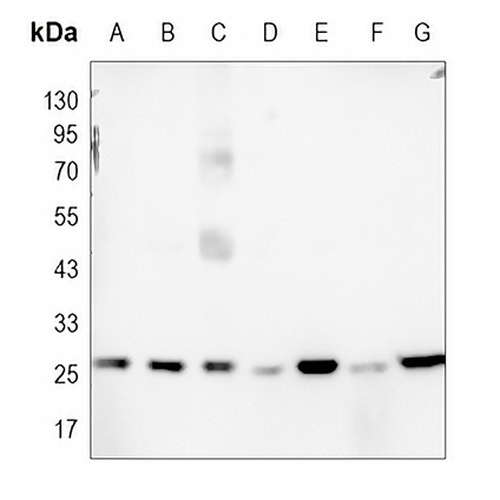 BCL2 Rabbit Monoclonal Antibody(C770)