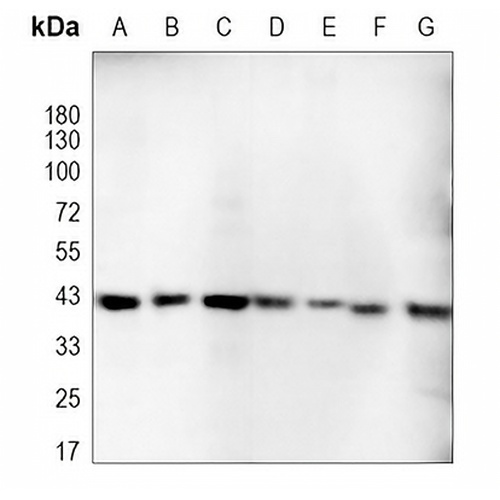 p38 Rabbit Monoclonal Antibody(C772)