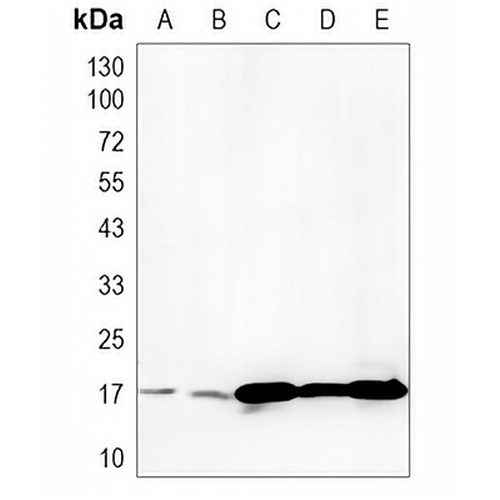 Histone H3 (Lactyl-K18) Rabbit Monoclonal Antibody(C774)