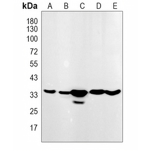 PEX7 Rabbit Monoclonal Antibody(C775)