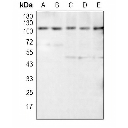 GAB1 Rabbit Monoclonal Antibody(C776)