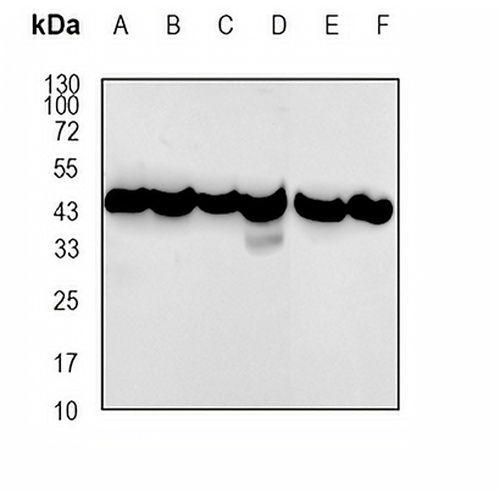 RIPK1 (Cleaved-D324) Rabbit Monoclonal Antibody(C777)