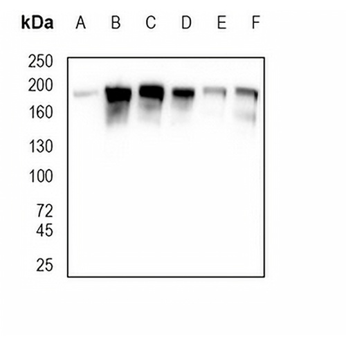 HER2 Rabbit Monoclonal Antibody(C778)