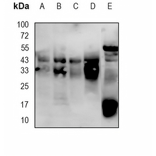 CDK10 Rabbit Monoclonal Antibody(C779)