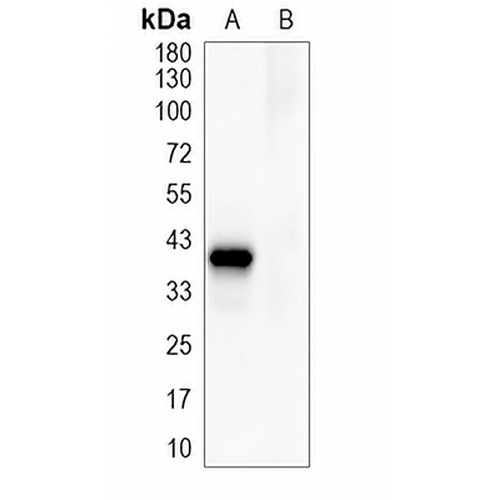 Flag-tag Mouse Monoclonal Antibody(C783)