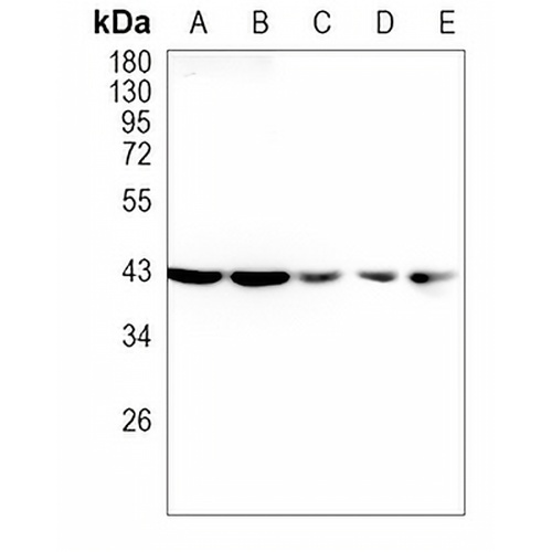 CCR7 Rabbit Monoclonal Antibody(C786)