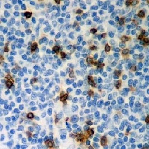 CD103 Rabbit Monoclonal Antibody(C787)