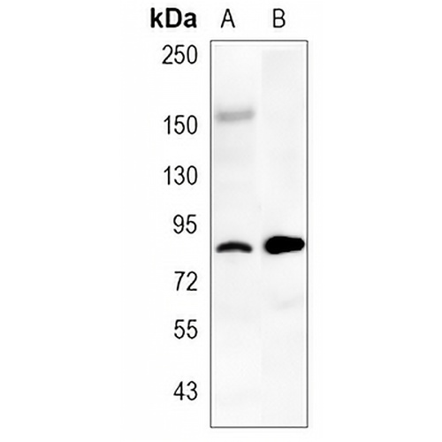 CD36 Rabbit Monoclonal Antibody(C788)