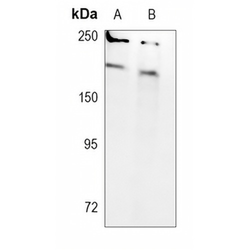 SMCHD1 Rabbit Monoclonal Antibody(C789)
