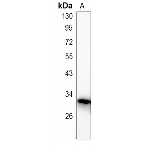 PP6 Rabbit Monoclonal Antibody(C790)