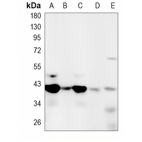 MacroH2A1 Rabbit Monoclonal Antibody(C794)