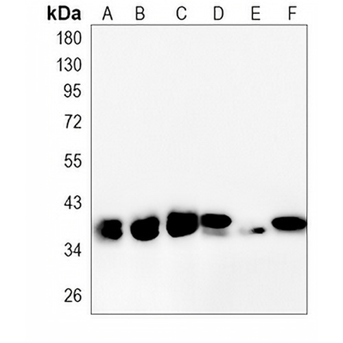 LDHA Rabbit Monoclonal Antibody(C797)