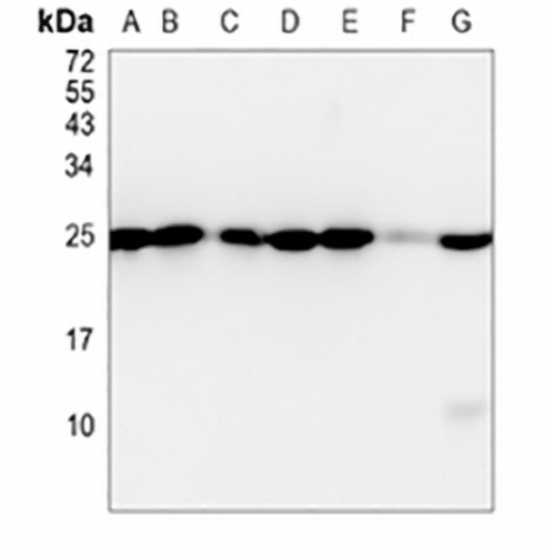 HPRT Rabbit Monoclonal Antibody(C798)