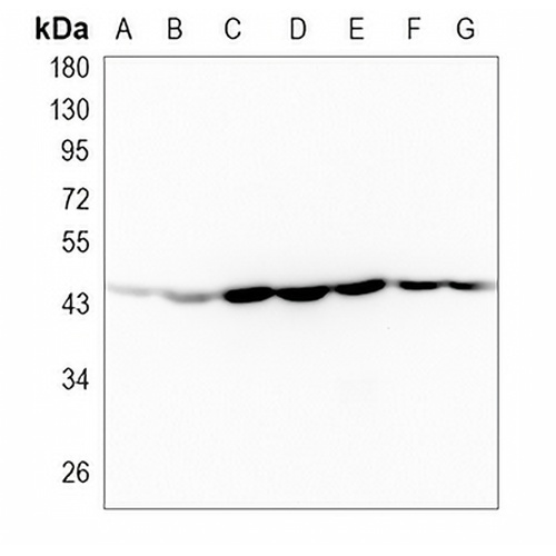 PGK1 Rabbit Monoclonal Antibody(C799)