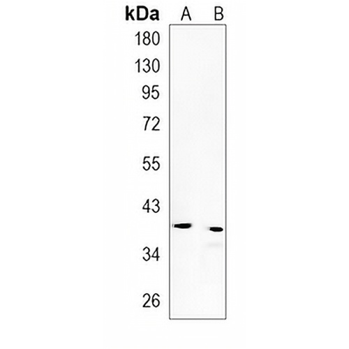 CD63 Rabbit Monoclonal Antibody(C802)