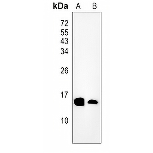 MGST1 Rabbit Monoclonal Antibody(C805)