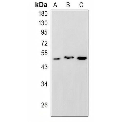 HAPLN1 Rabbit Monoclonal Antibody(C806)