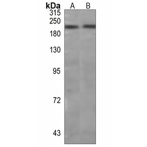 Laminin gamma 1 Rabbit Monoclonal Antibody(C807)