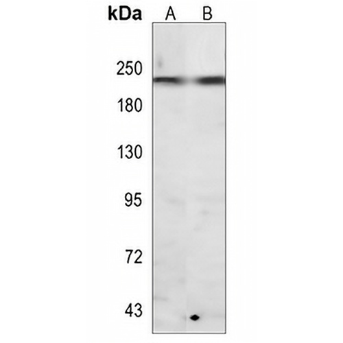 Myosin Heavy Chain 6/7 Rabbit Monoclonal Antibody(C808)