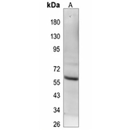 EGR-1 Rabbit Monoclonal Antibody(C809)