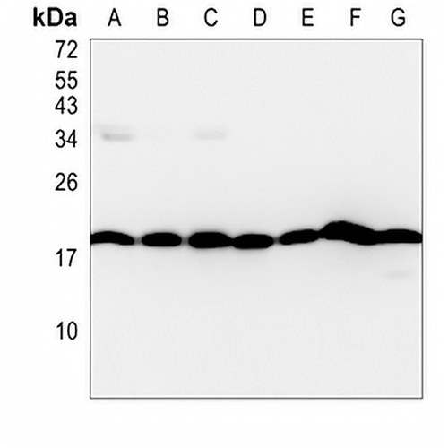 Cyclophilin B Rabbit Monoclonal Antibody(C811)