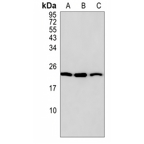 AK4 Rabbit Monoclonal Antibody(C813)