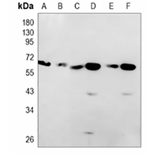 STIP1 Rabbit Monoclonal Antibody(C814)