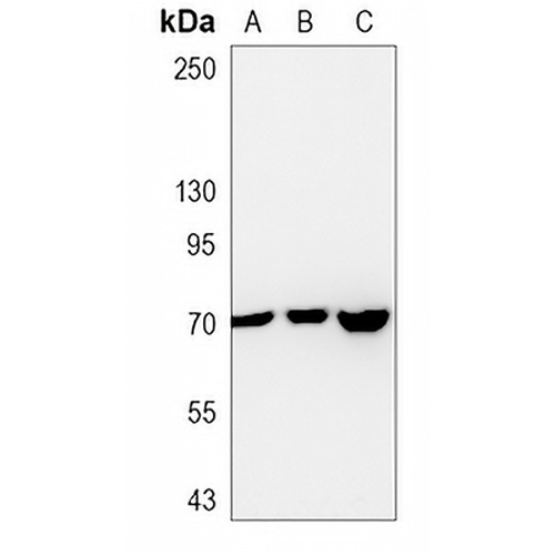 EPHX2 Rabbit Monoclonal Antibody(C815)