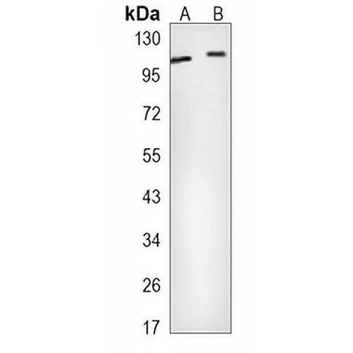 Alpha E-catenin Rabbit Monoclonal Antibody(C816)