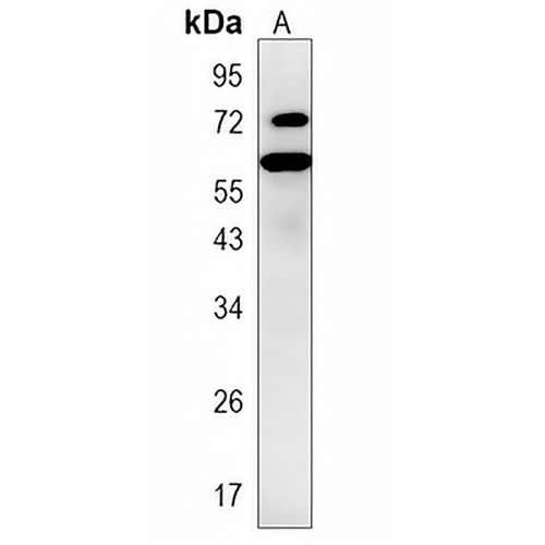 PGHS-2 Rabbit Monoclonal Antibody(C817)