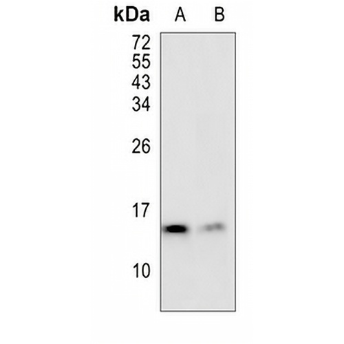 SAA4 Rabbit Monoclonal Antibody(C818)
