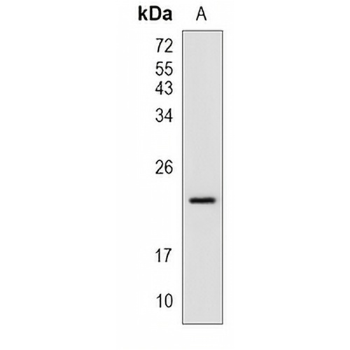 p21 Rabbit Monoclonal Antibody(C820)