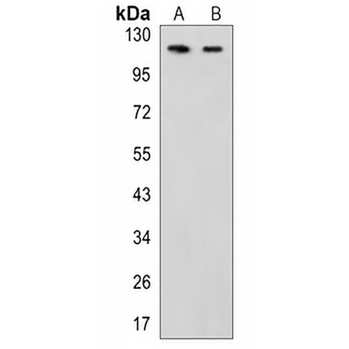 TRPC1 Rabbit Monoclonal Antibody(C823)